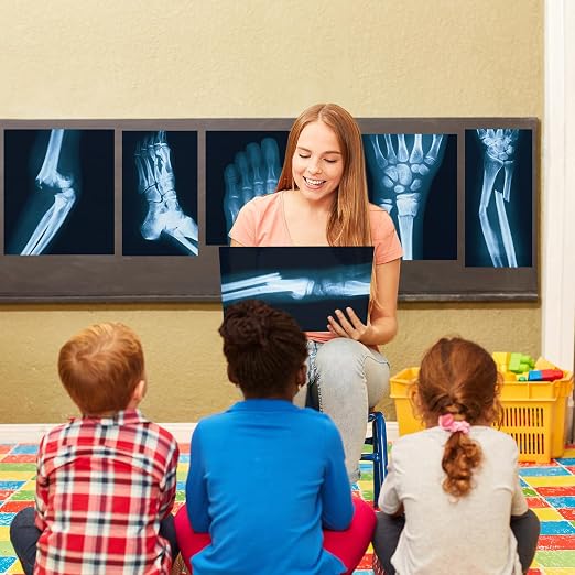 Sayglossy 15 Pcs Broken Bones x Ray Set Human x Rays Black and Blue Skeleton Pretend Xrays for Kids - Image 6