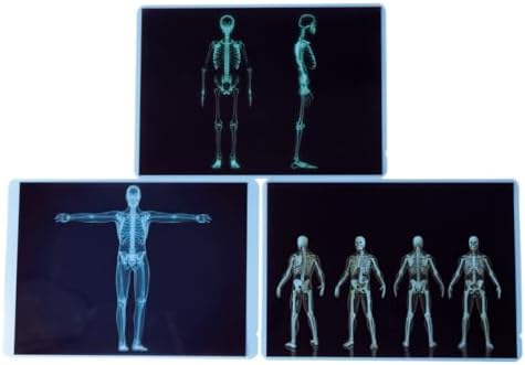 21 Pieces Human X-Ray Sets - Light Table Accessories - Image 5