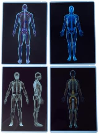 21 Pieces Human X-Ray Sets - Light Table Accessories - Image 4