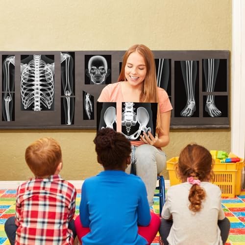 Lineshading 16 Pieces Human x Rays Bones Pretend x Rays for Kids Human Bones Body Educational Science Kit Display Play Table(Black and White) - Image 5