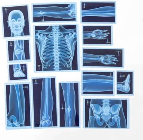 21 Pieces Human X-Ray Sets - Light Table Accessories - Image 3