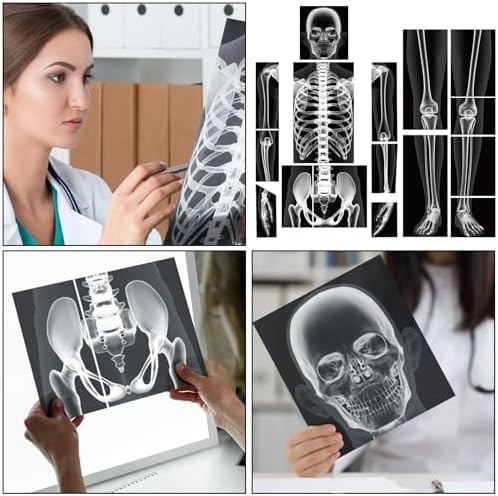 Lineshading 16 Pieces Human x Rays Bones Pretend x Rays for Kids Human Bones Body Educational Science Kit Display Play Table(Black and White) - Image 6