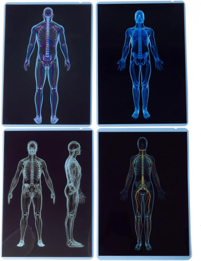 21 Pieces X-Ray Sets of Human Skeleton - Bright LED Light Box - Human Nerves, Human Blood Vessels and Human Lymphatic - Xray for Light Table - Image 3