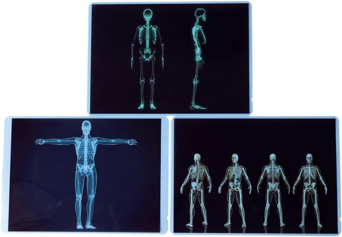 21 Pieces X-Ray Sets of Human Skeleton - Bright LED Light Box - Human Nerves, Human Blood Vessels and Human Lymphatic - Xray for Light Table - Image 4