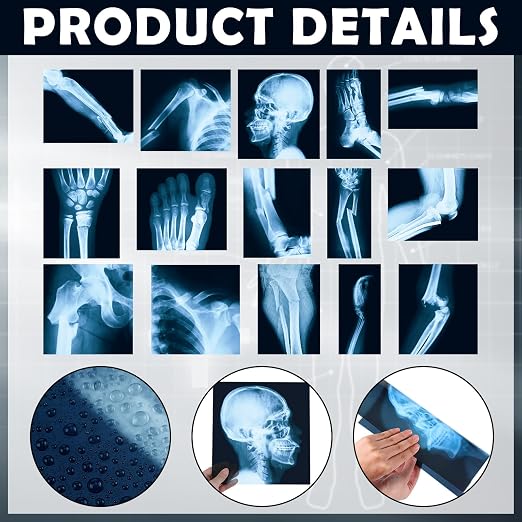 Sayglossy 15 Pcs Broken Bones x Ray Set Human x Rays Black and Blue Skeleton Pretend Xrays for Kids - Image 3