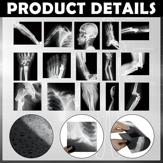 Sayglossy 15 Pcs Human X-Rays Black and White Skeleton Anatomy Set - Image 3