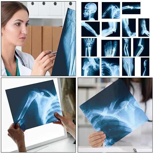 Sayglossy 15 Pcs Broken Bones x Ray Set Human x Rays Black and Blue Skeleton Pretend Xrays for Kids - Image 4