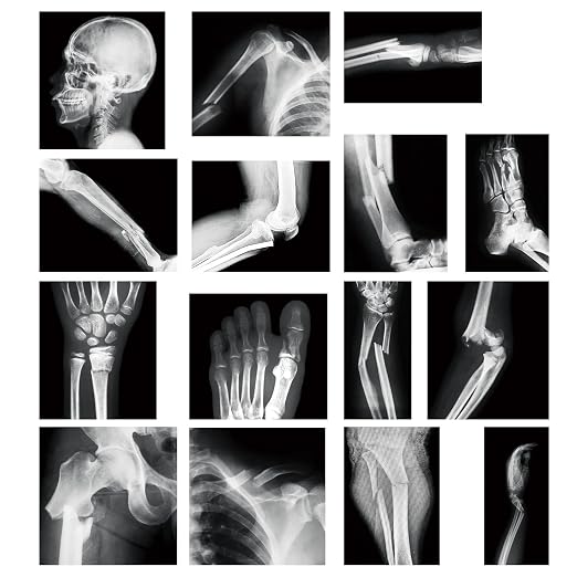 Sayglossy 15 Pcs Human X-Rays Black and White Skeleton Anatomy Set by Sayglossy