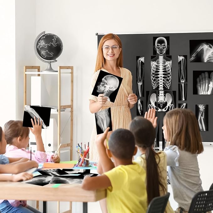Novabright 31 Pcs Broken Human Bones x Ray Set for Kids Human X-Rays Skeleton Pretend Skeleton Pretend for Kids Body Display Play Table Educational Science Kits Black and White - Image 7