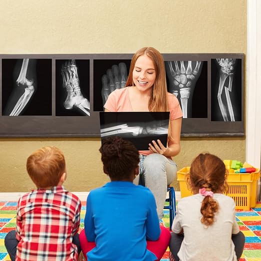 Sayglossy 15 Pcs Human X-Rays Black and White Skeleton Anatomy Set - Image 6