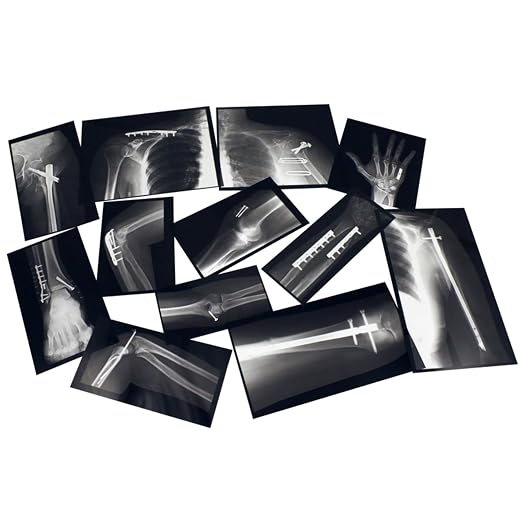 Roylco R-59255 Fixed Bones X-Rays, Black/White, 14 Pieces, Model:R59255 by Roylco