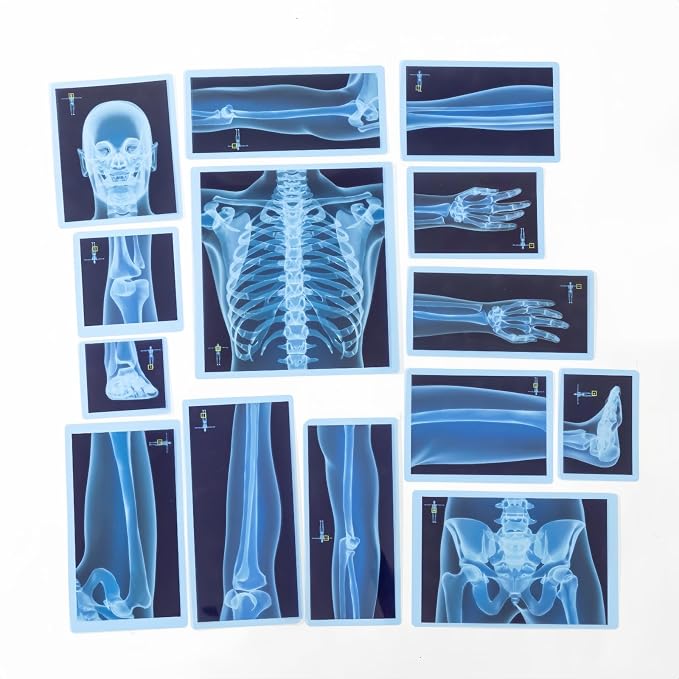 21 Pieces X-Ray Sets of Human Skeleton - Bright LED Light Box - Human Nerves, Human Blood Vessels and Human Lymphatic - Xray for Light Table - Image 2