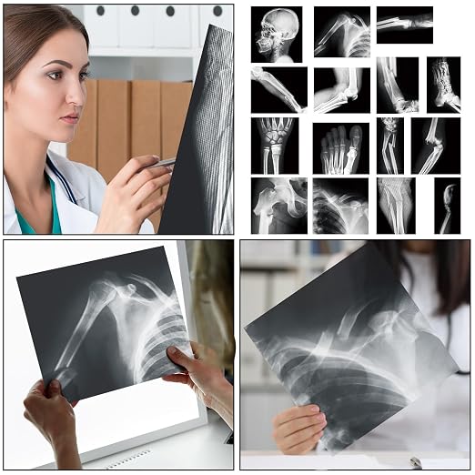 Sayglossy 15 Pcs Human X-Rays Black and White Skeleton Anatomy Set - Image 4