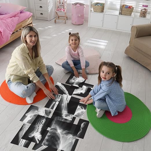 Sayglossy 15 Pcs Human X-Rays Black and White Skeleton Anatomy Set - Image 5