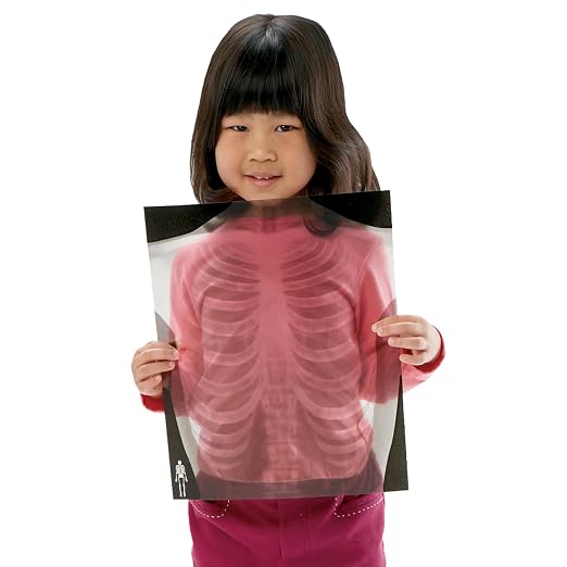 Human X-Rays – 18-Piece Life-Size Skeletal Set for Light Table or Window Exploration, Ages 5+ - Image 2