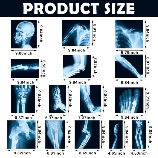 Sayglossy 15 Pcs Broken Bones x Ray Set Human x Rays Black and Blue Skeleton Pretend Xrays for Kids - Image 2