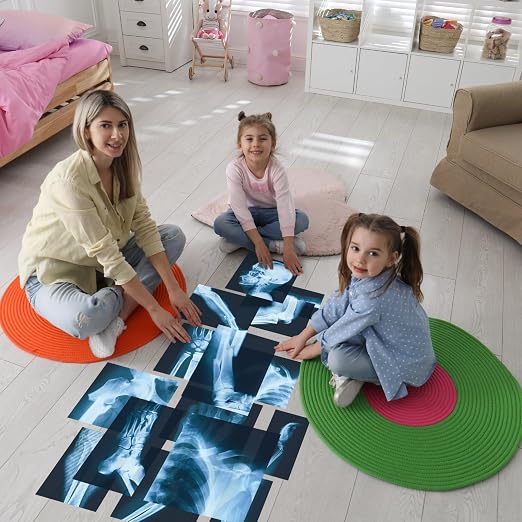 Sayglossy 15 Pcs Broken Bones x Ray Set Human x Rays Black and Blue Skeleton Pretend Xrays for Kids - Image 5
