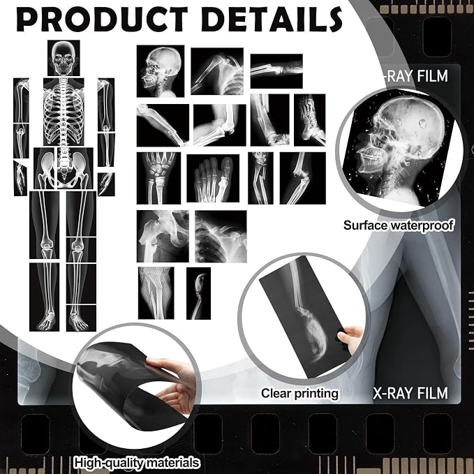 Novabright 31 Pcs Broken Human Bones x Ray Set for Kids Human X-Rays Skeleton Pretend Skeleton Pretend for Kids Body Display Play Table Educational Science Kits Black and White - Image 4