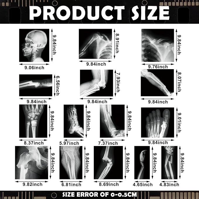 Novabright 31 Pcs Broken Human Bones x Ray Set for Kids Human X-Rays Skeleton Pretend Skeleton Pretend for Kids Body Display Play Table Educational Science Kits Black and White - Image 2