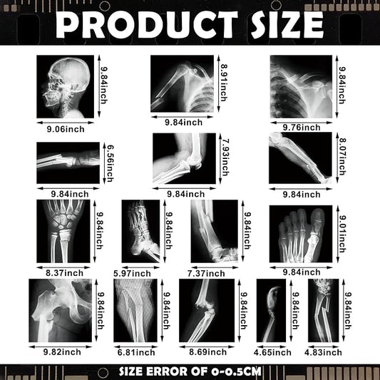 Novabright 31 Pcs Broken Human Bones x Ray Set for Kids Human X-Rays Skeleton Pretend Skeleton Pretend for Kids Body Display Play Table Educational Science Kits Black and White - Image 2