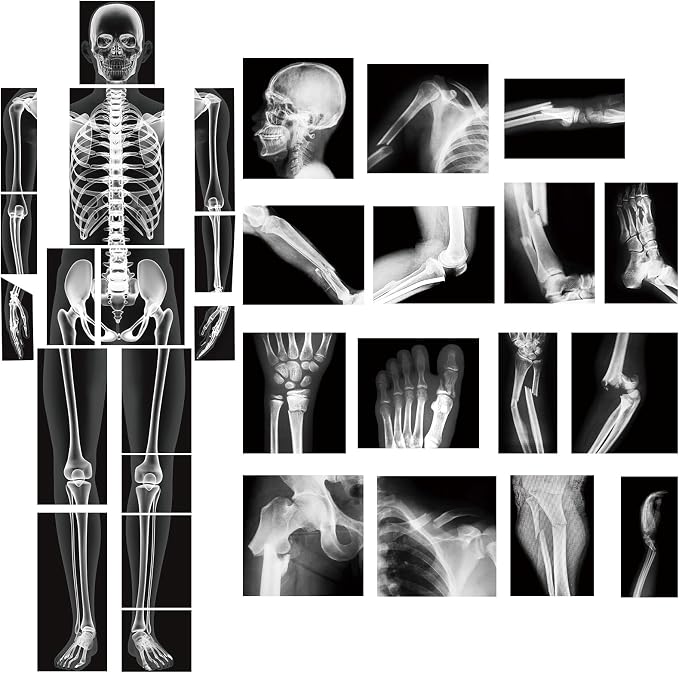 Novabright 31 Pcs Broken Human Bones x Ray Set for Kids Human X-Rays Skeleton Pretend Skeleton Pretend for Kids Body Display Play Table Educational Science Kits Black and White by Unknown