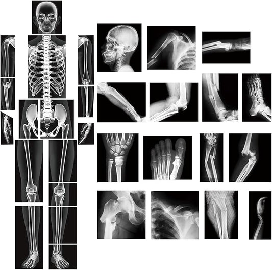 Novabright 31 Pcs Broken Human Bones x Ray Set for Kids Human X-Rays Skeleton Pretend Skeleton Pretend for Kids Body Display Play Table Educational Science Kits Black and White by Unknown