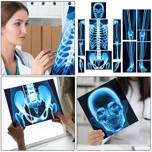 Lineshading 16 Pieces Human x Rays Bones Pretend x Rays for Kids Human Bones Body Educational Science Kit Display Play Table(Blue) - Image 4