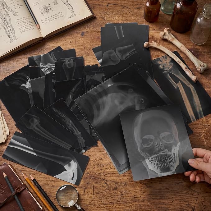 Novabright 31 Pcs Broken Human Bones x Ray Set for Kids Human X-Rays Skeleton Pretend Skeleton Pretend for Kids Body Display Play Table Educational Science Kits Black and White - Image 5