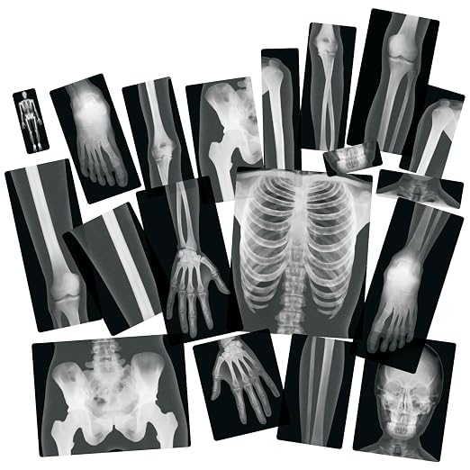 Human X-Rays – 18-Piece Life-Size Skeletal Set for Light Table or Window Exploration, Ages 5+ - Image 3