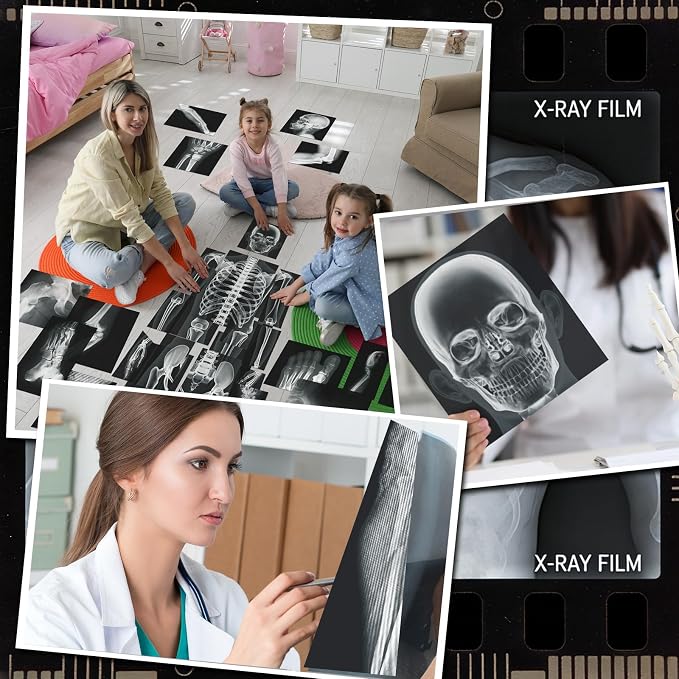 Novabright 31 Pcs Broken Human Bones x Ray Set for Kids Human X-Rays Skeleton Pretend Skeleton Pretend for Kids Body Display Play Table Educational Science Kits Black and White - Image 6
